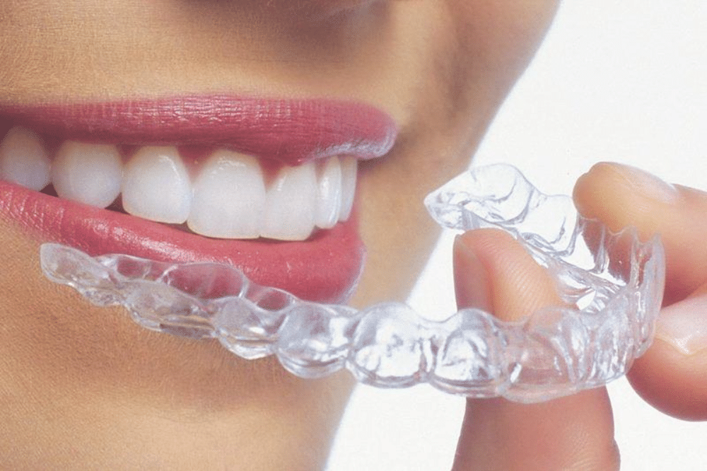 Who Is A Candidate For Invisalign?